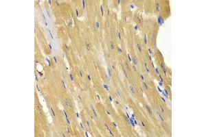 Immunohistochemistry of paraffin-embedded mouse heart using  antibody (ABIN3021755, ABIN3021756, ABIN3021757 and ABIN6215776) at dilution of 1:100 (40x lens). (Adenylate Kinase 1 抗体  (AA 1-194))