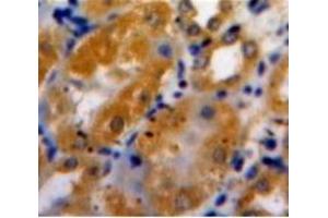 Used in DAB staining on fromalin fixed paraffin-embedded Kidney tissue (ADAMTS1 抗体  (AA 854-967))