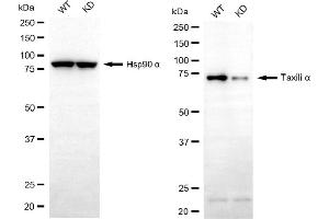 Western blotting analysis using taxilin alpha antibody (ABIN7800520). (alpha Taxilin 抗体)