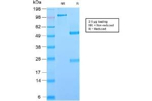 SDS-PAGE Analysis Purified GP2 Recombinant Rabbit Monoclonal Antibody (GP2/2569R). (Recombinant GP2 抗体  (AA 35-179))