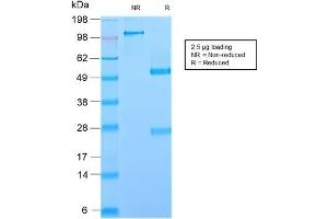 SDS-PAGE Analysis Purified GP2 Recombinant Rabbit Monoclonal Antibody (GP2/2569R). (Recombinant GP2 抗体  (AA 35-179))