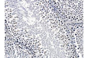 Ubiquitin Mouse Monoclonal Antibody at 1/100 staining rat testis tissue by IHC-P.