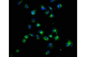 Immunofluorescence staining of Hela cells with ABIN7165221 at 1:22, counter-stained with DAPI. (CRB1 抗体  (AA 20-200))