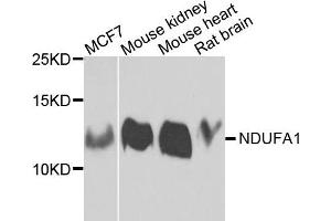 Western blot analysis of extracts of various cells, using NDUFA1 antibody. (NDUFA1 抗体)