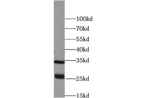 Western blot analysis of Raji cells subjected to SDS-PAGE, using PRSS2 antibody (1/500 dilution). (PRSS2 抗体)