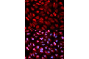 Immunofluorescence (IF) image for anti-Poly(rC) Binding Protein 2 (PCBP2) (AA 1-130) antibody (ABIN6219620) (PCBP2 抗体  (AA 1-130))