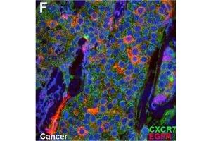 Immunofluorescence (Cultured Cells) (IF (cc)) image for anti-Chemokine (C-X-C Motif) Receptor 7 (CXCR7) antibody (ABIN2857021)