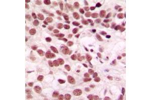 Immunohistochemistry (IHC) image for anti-CTD (Carboxy-terminal Domain, RNA Polymerase II, Polypeptide A) Small Phosphatase 1 (CTDSP1) (N-Term) antibody (ABIN7298296)