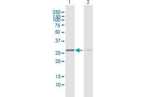 Western Blot analysis of ANP32B expression in transfected 293T cell line by ANP32B MaxPab polyclonal antibody. (ANP32B 抗体  (AA 1-251))