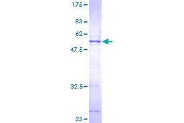 SERTAD1 Protein (AA 1-236) (GST tag)