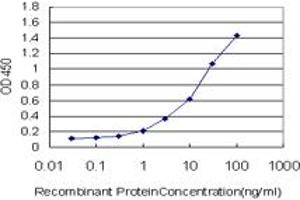 Detection limit for recombinant GST tagged ZNF263 is approximately 0. (ZNF263 抗体  (AA 201-298))