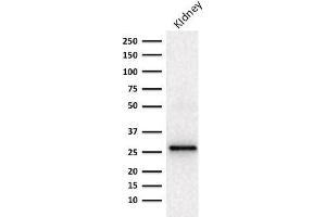 Western blot Analysis of human Kidney lysate using Adiponectin Mouse Monoclonal Antibody (ADPN/1370). (ADIPOQ 抗体  (AA 145-226))