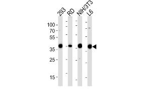 Western Blotting (WB) image for anti-Aldolase (ALD) antibody (ABIN3001589) (Aldolase 抗体)