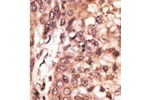 Image no. 2 for anti-CAMP Responsive Element Binding Protein 3-Like 1 (CREB3L1) (AA 490-519), (C-Term) antibody (ABIN358719) (CREB3L1 抗体  (C-Term))