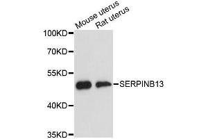 Western blot analysis of extracts of various cell lines, using SERPINB13 antibody. (SERPINB13 抗体  (AA 1-140))