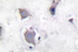 Image no. 2 for anti-Neurotrophic Tyrosine Kinase, Receptor, Type 2 (NTRK2) (pTyr705) antibody (ABIN318147) (TRKB 抗体  (pTyr705))