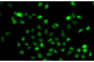 Immunofluorescence analysis of A549 cells using BCL6 Polyclonal Antibody (BCL6 抗体)