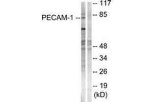 Western blot analysis of extracts from Jurkat cells, using PECAM-1 (Ab-713) Antibody. (CD31 抗体  (AA 686-735))
