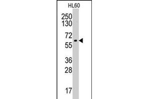 Western blot analysis of CYP19A1 polyclonal antibody  in HL-60 cell line lysates (35 ug/lane). (Aromatase 抗体  (Internal Region))