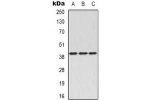 Western blot analysis of CD88 expression in A549 (A), mouse brain (B), rat spleen (C) whole cell lysates. (C5AR1 抗体  (N-Term))