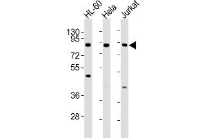 All lanes : Anti-IKK beta Antibody at 1:4000 dilution Lane 1: HL-60 whole cell lysates Lane 2: Hela whole cell lysates Lane 3: Jurkat whole cell lysates Lysates/proteins at 20 μg per lane. (IKBKB 抗体)