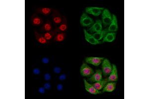 PHF8 Antibody staining Hela cells by IF/ICC. (PHF8 抗体  (C-Term))
