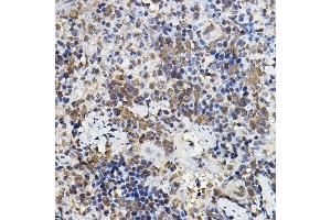 Immunohistochemistry (IHC) image for anti-Period Circadian Protein 2 (PER2) (AA 1-150) antibody (ABIN6145450)