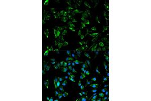 Immunofluorescence analysis of HeLa cell using TPM3 antibody. (TPM3 抗体)