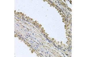 Immunohistochemistry of paraffin-embedded human prostate using MEMO1 antibody at dilution of 1:100 (x40 lens).
