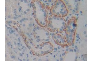 DAB staining on IHC-P; Samples: Human Kidney Tissue (CNTF Receptor alpha 抗体  (AA 120-358))