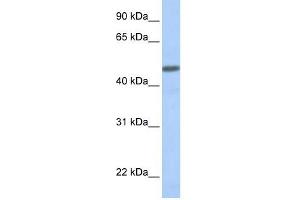 CALCRL antibody used at 1 ug/ml to detect target protein. (CALCRL 抗体  (N-Term))