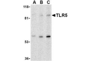 Image no. 1 for anti-Toll-Like Receptor 5 (TLR5) (C-Term) antibody (ABIN265142) (TLR5 抗体  (C-Term))