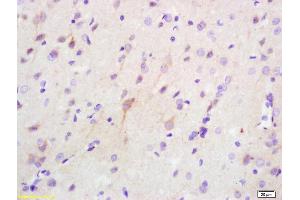 Formalin-fixed and paraffin embedded rat brain labeled with Anti Phospho-PKR (Thr446 + Thr451) Polyclonal Antibody (ABIN744818), Unconjugated at 1:200, followed by conjugation to the secondary antibody and DAB staining