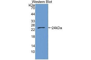Western Blotting (WB) image for anti-Growth Arrest-Specific 6 (GAS6) (AA 136-311) antibody (ABIN3209085) (GAS6 抗体  (AA 136-311))