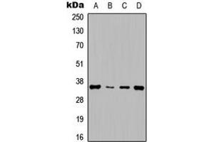 Western blot analysis of Cyclin D1 expression in HepG2 (A), NIH3T3 (B), rat muscle (C), rat kidney (D) whole cell lysates. (Cyclin D1 抗体  (Center))