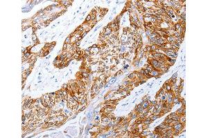 Immunohistochemistry (IHC) image for anti-Gastrin-Releasing Peptide Receptor (GRPR) (AA 235-384) antibody (ABIN6219927) (GRPR 抗体  (AA 235-384))