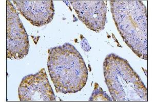 IHC analysis of BubR1/BUB1B using anti-BubR1/BUB1B antibody (ABIN7600962). (BUB1B 抗体  (AA 26-448))