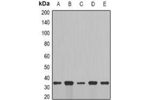 Western blot analysis of Cyclin C expression in MCF7 (A), NIH3T3 (B), mouse brain (C), mouse lung (D), rat liver (E) whole cell lysates. (Cyclin C 抗体)
