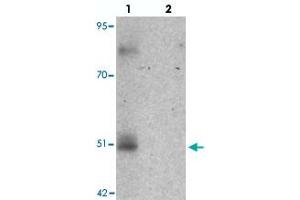 Western blot analysis of FOXD4L1 in A-20 cell lysate with FOXD4L1 polyclonal antibody  at 1 ug/mL in (lane 1) the absence and (lane 2) the presence of blocking peptide.