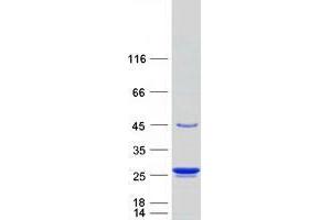 Transgelin 3 (TAGLN3) (Transcript Variant 1) protein (Myc-DYKDDDDK Tag)