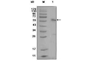 Western Blot showing ESR1 antibody used against MCF-7 cell lysate (1)