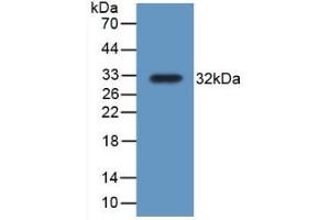 Detection of Recombinant TrxR1, Rat using Polyclonal Antibody to Thioredoxin Reductase 1 (TXNRD1) (TXNRD1 抗体  (AA 208-433))