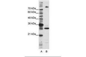 Image no. 2 for anti-serine/arginine-Rich Splicing Factor 10 (SRSF10) (C-Term) antibody (ABIN6736232) (SRSF10 抗体  (C-Term))