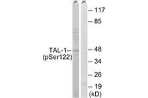 Western blot analysis of extracts from Jurkat cells treated with PMA 125ng/ml 30', using TAL-1 (Phospho-Ser122) Antibody. (TAL1 抗体  (pSer122))