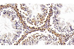 Detection of HMGB1 in Mouse Testis Tissue using Polyclonal Antibody to High Mobility Group Protein 1 (HMGB1) (HMGB1 抗体  (AA 1-215))