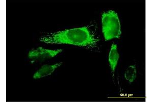 Immunofluorescence of purified MaxPab antibody to PRDX3 on HeLa cell.