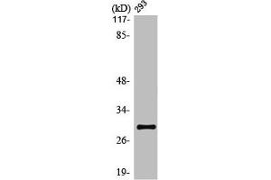 Western Blot analysis of Jurkat cells using Olfactory receptor 10J1 Polyclonal Antibody (OR1J1 抗体  (C-Term))
