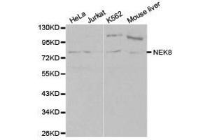 Western Blotting (WB) image for anti-NIMA-Related Kinase 8 (NEK8) antibody (ABIN1873874) (NEK8 抗体)