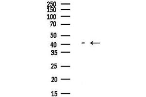 Western blot analysis of lysates from Hela cells(UV,30 min treatment), using C Antibody at 1/1000 dilution.