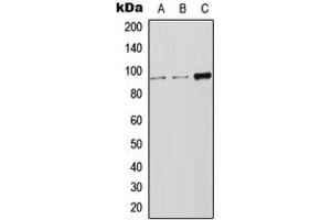 Western blot analysis of LRP12 expression in Jurkat (A), HeLa (B), SP2/0 (C) whole cell lysates. (LRP12 抗体  (Center))